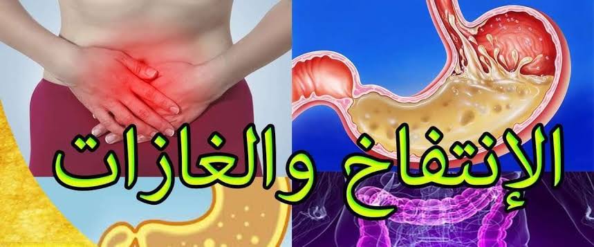 علاج الحموضة والغازات - طريقه فعاله للحموضه 7817 13